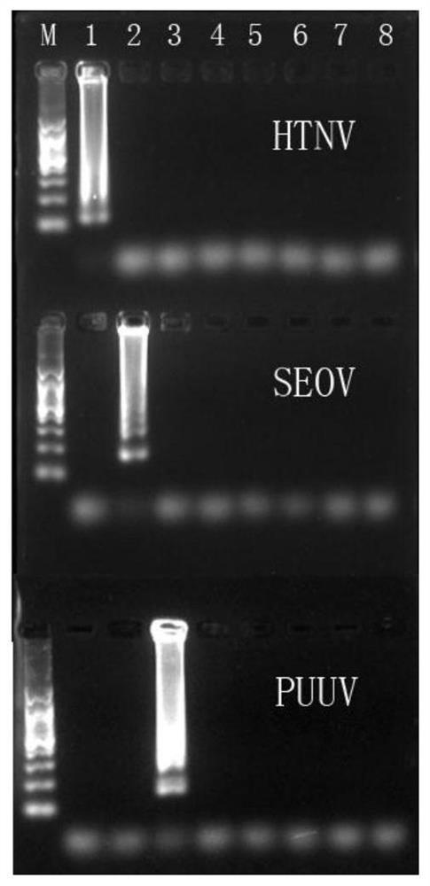 用于檢測漢坦病毒的檢測引物、檢測試劑盒及檢測方法