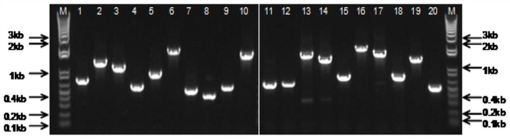 一種棘阿米巴特異性抗原肽、多克隆抗體及其用途